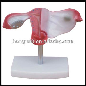 ISO Natural size uterus model,Anatomical Uterus Model